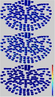 Regional and Temporal Differences in Brain Activity With Morally Good or Bad Judgments in Men: A Magnetoencephalography Study